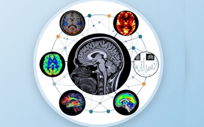 Trois journées consacrées à l'imagerie des maladies mentales et neurodégénératives