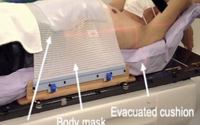 Un masque-ballon abdominal pour une bonne contention lors d'une SBRT du rachis lombaire