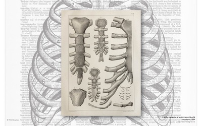 N°363 - Le vissage sternal en radiologie interventionnelle