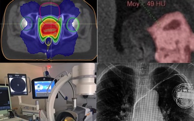 De nouveaux protocoles de coopération recensés par le CNPMEM