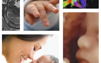 N°336 - Le manipulateur au coeur de l'innovation dans la recherche en imagerie fœtale