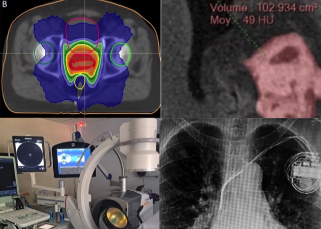 De nouveaux protocoles de coopération recensés par le CNPMEM