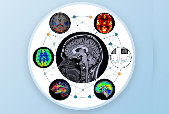 Trois journées consacrées à l'imagerie des maladies mentales et neurodégénératives
